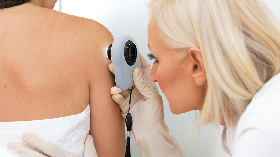 Read more about the article Dermatology Basics: 5 Signs a Mole Could Be Cancerous